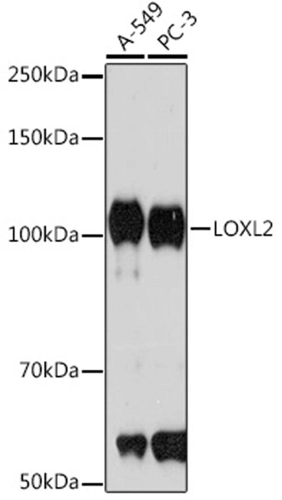 Western blot - LOXL2 Rabbit mAb (A4708)