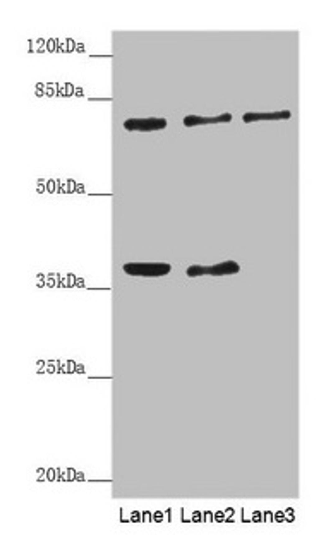 Western blot. All lanes: GAS2L1 antibody at 0.71µg/ml. Lane 1: A431 whole cell lysate. Lane 2: Hela whole cell lysate. Lane 3: 293T whole cell lysate. Secondary. Goat polyclonal to rabbit IgG at 1/10000 dilution. Predicted band size: 73, 37, 35, 49 kDa. Observed band size: 73, 37 kDa