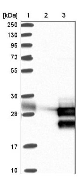 Western Blot: TCF21 Antibody [NBP1-88637] - Lane 1: Marker [kDa] 250, 130, 95, 72, 55, 36, 28, 17, 10<br/>Lane 2: Negative control (vector only transfected HEK293T lysate)<br/>Lane 3: Over-expression lysate (Co-expressed with a C-terminal myc-DDK tag (~3.1 kDa) in mammalian HEK293T cells, LY418825)