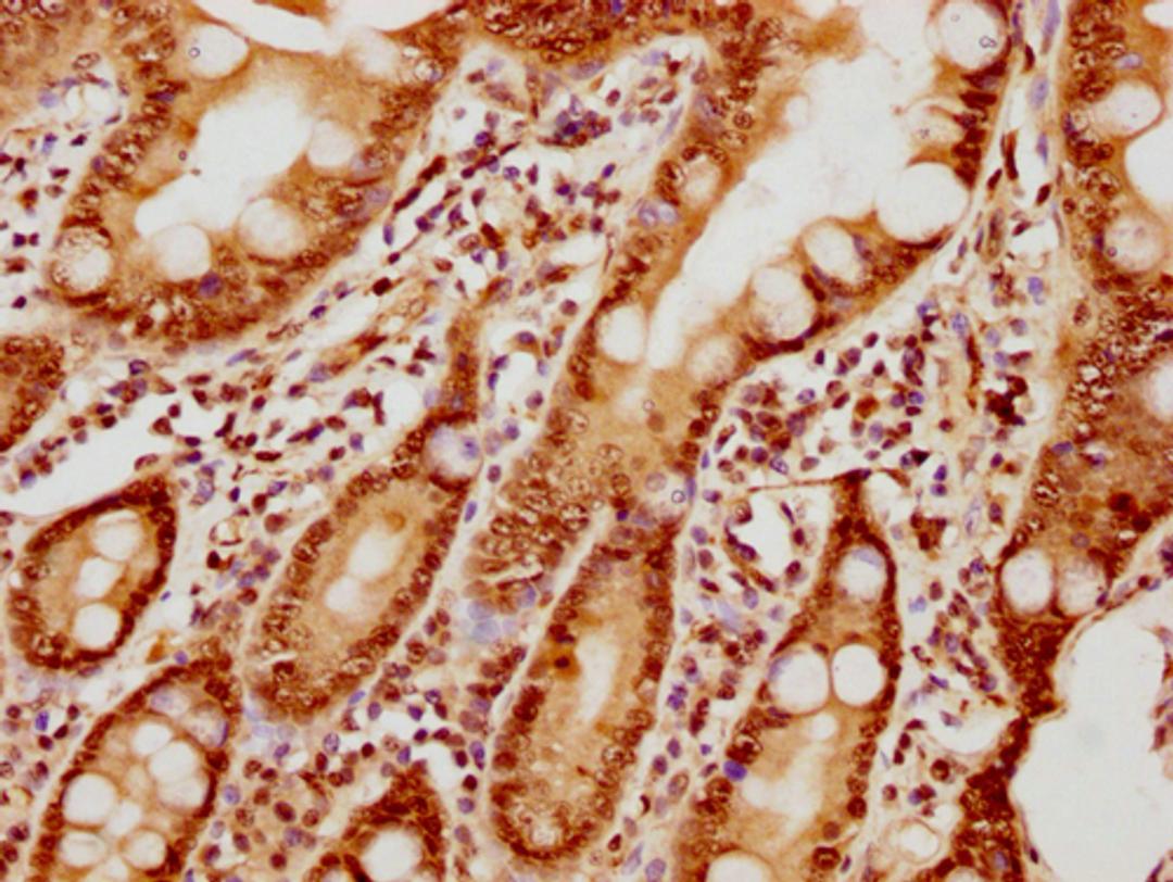 IHC image of CSB-PA010377OA10nphHU diluted at 1:10 and staining in paraffin-embedded human small intestine tissue performed on a Leica BondTM system. After dewaxing and hydration, antigen retrieval was mediated by high pressure in a citrate buffer (pH 6.0). Section was blocked with 10% normal goat serum 30min at RT. Then primary antibody (1% BSA) was incubated at 4°C overnight. The primary is detected by a biotinylated secondary antibody and visualized using an HRP conjugated SP system.
