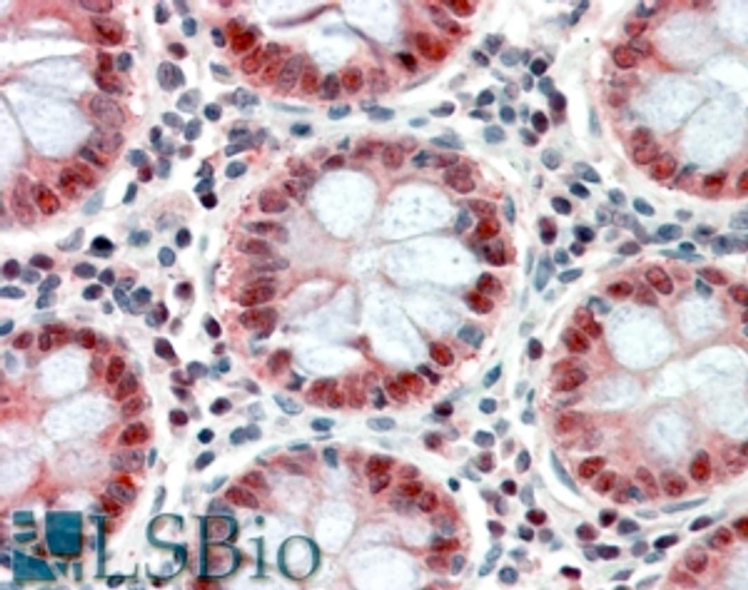 46-245 (3.8ug/ml) staining of paraffin embedded Human Colon. Steamed antigen retrieval with citrate buffer pH 6, AP-staining.