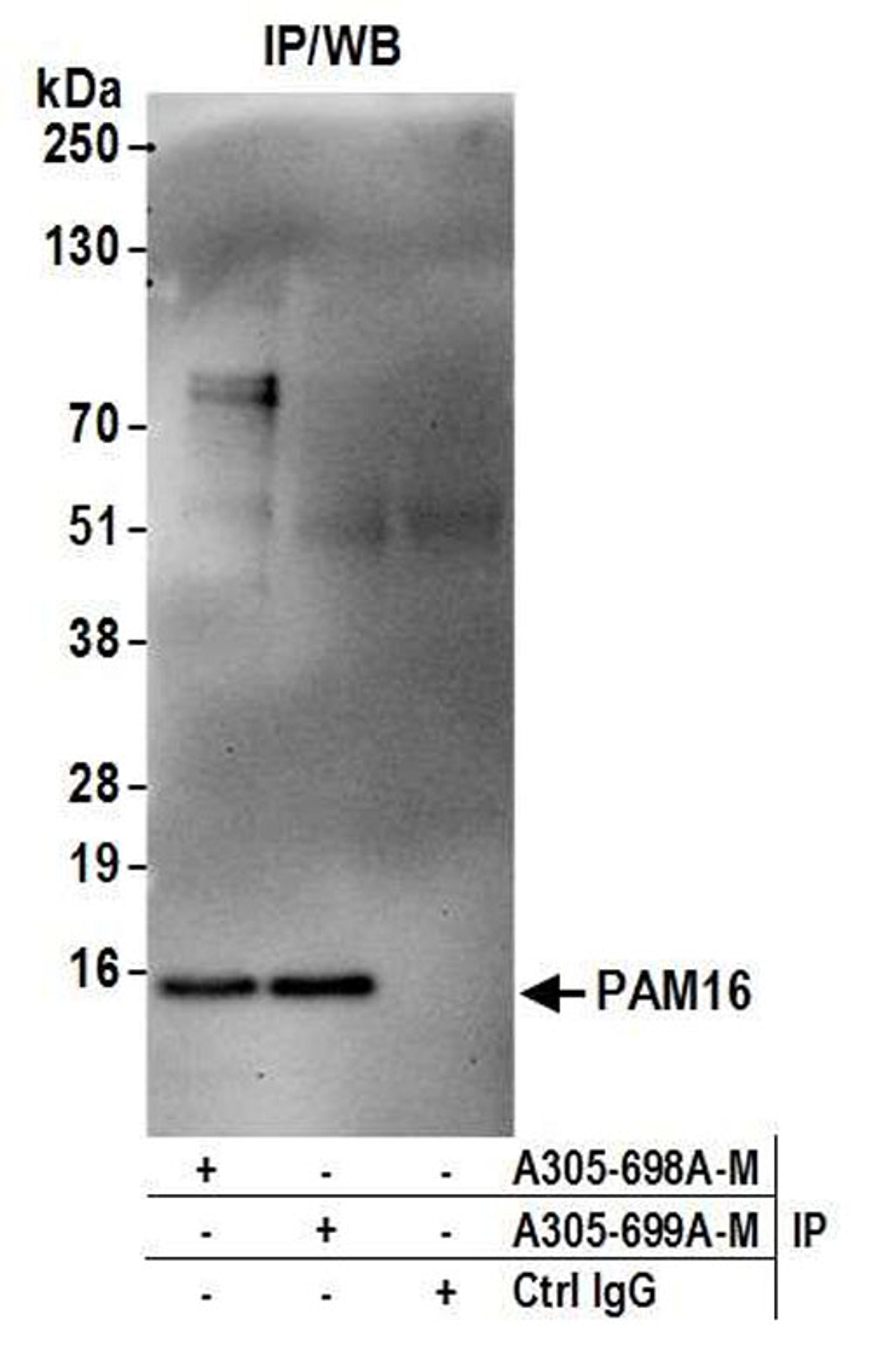 Detection of human PAM16 by WB of IP.