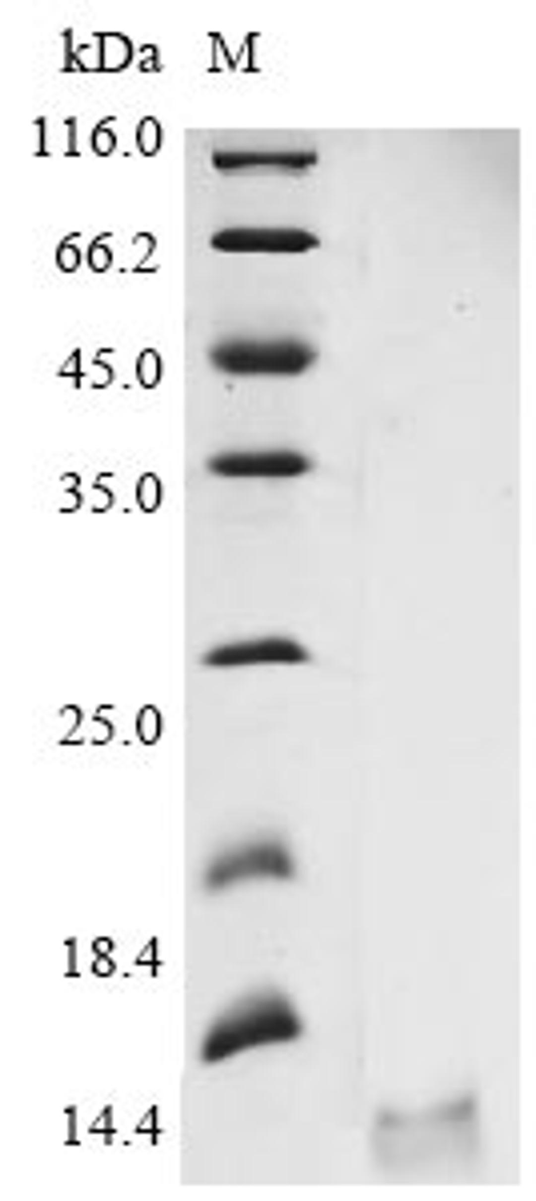 (Tris-Glycine gel) Discontinuous SDS-PAGE (reduced) with 5% enrichment gel and 15% separation gel.