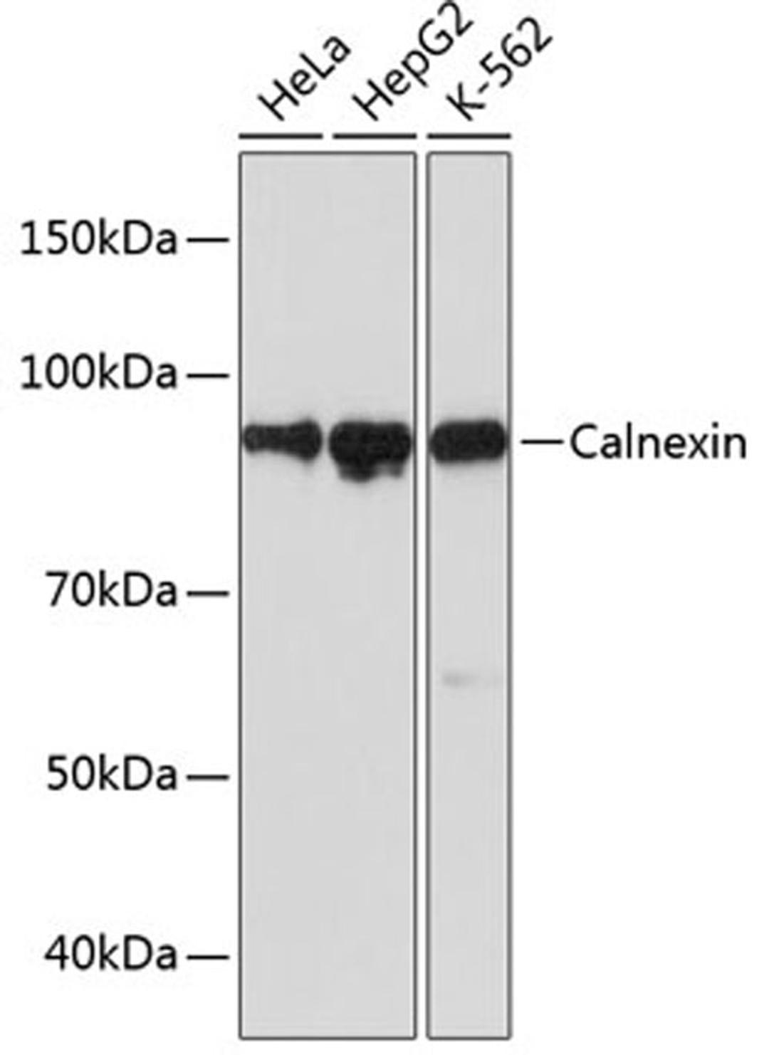 Western blot - Calnexin antibody (A4846)