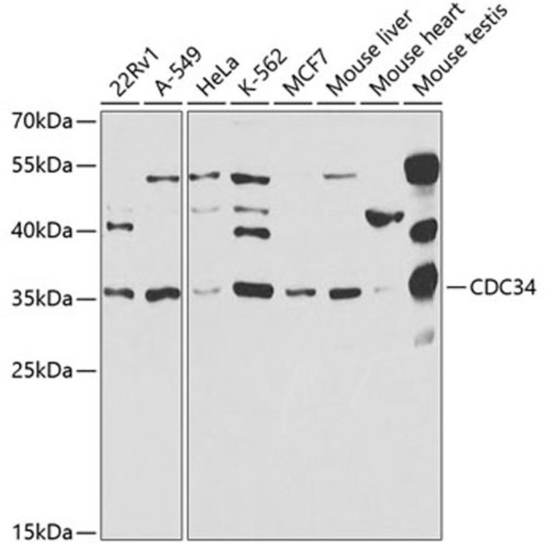 Western blot - CDC34 antibody (A5457)