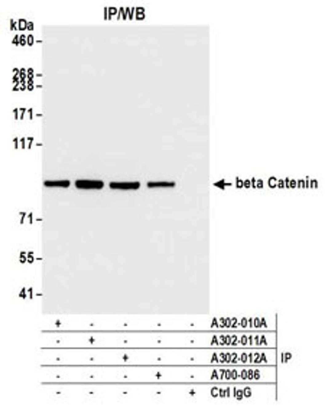 Detection of human beta Catenin by western blot of immunoprecipitates.