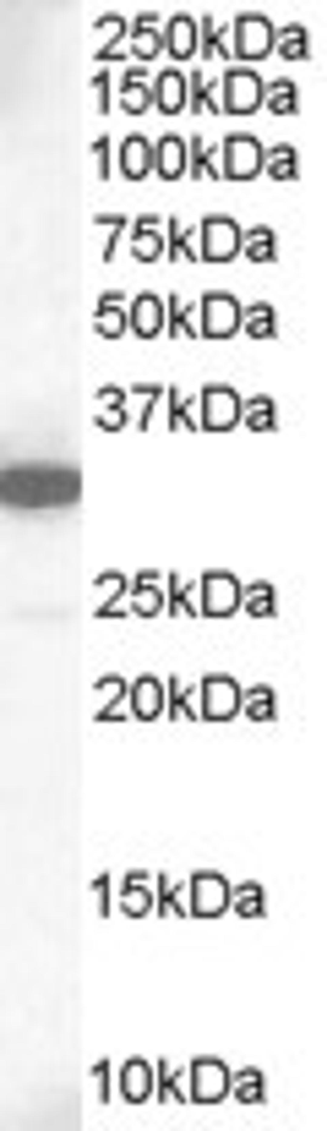 45-872 staining (1ug/ml) of Human Lung lysate (RIPA buffer, 35ug total protein per lane). Primary incubated for 1 hour. Detected by chemiluminescence.