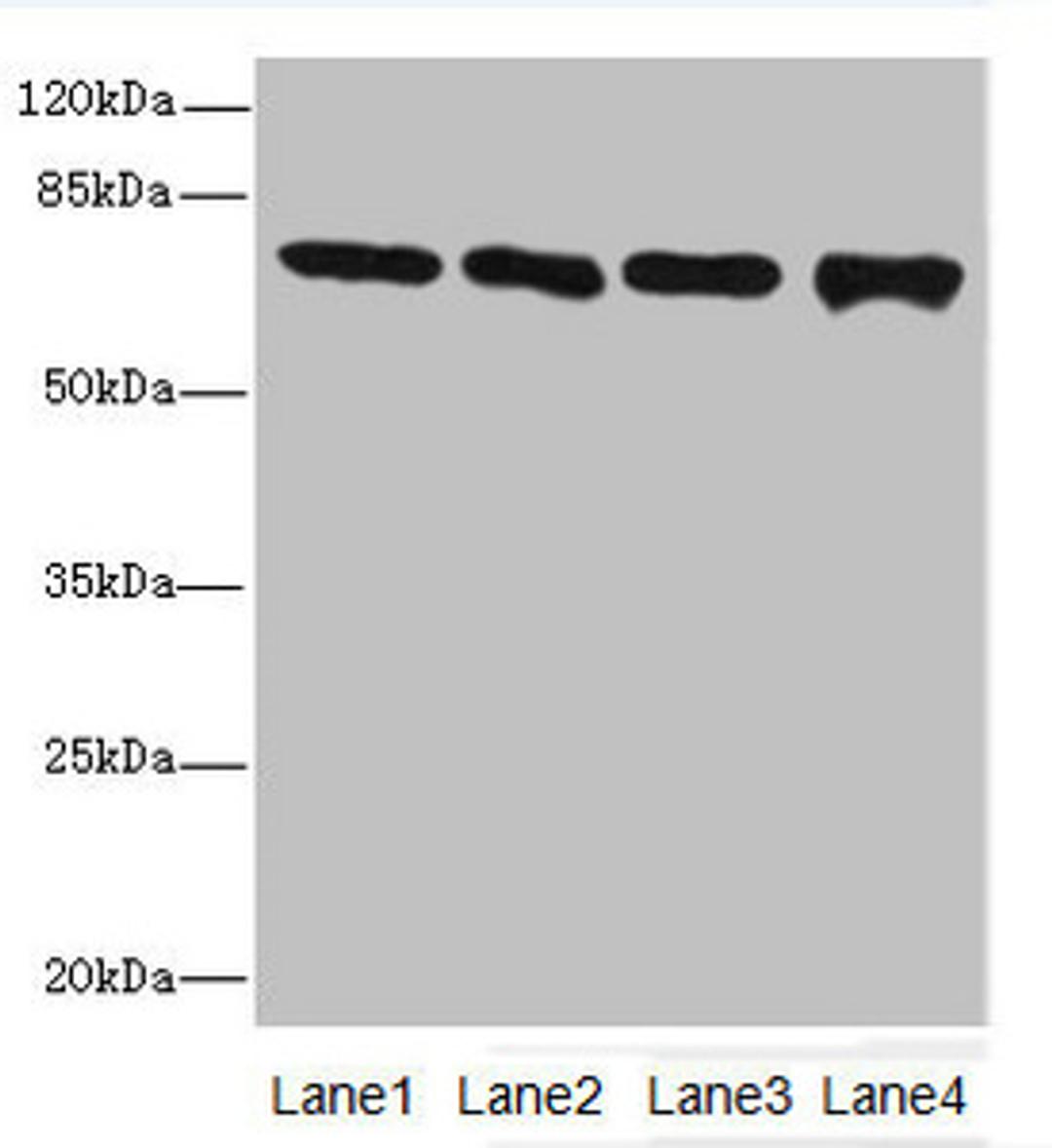 Western blot. All lanes: Protein-arginine deiminase type-2 antibody at 16ug/ml. Lane 1: PC-3 whole cell lysate. Lane 2: Hela whole cell lysate. Lane 3: Mouse brain tissue. Lane 4: MDA-MB-231 whole cell lysate. Secondary. Goat polyclonal to rabbit IgG at 1/10000 dilution. Predicted band size: 76, 50 kDa. Observed band size: 76 kDa. 