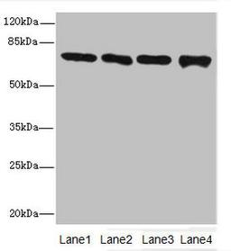 Western blot. All lanes: Protein-arginine deiminase type-2 antibody at 16ug/ml. Lane 1: PC-3 whole cell lysate. Lane 2: Hela whole cell lysate. Lane 3: Mouse brain tissue. Lane 4: MDA-MB-231 whole cell lysate. Secondary. Goat polyclonal to rabbit IgG at 1/10000 dilution. Predicted band size: 76, 50 kDa. Observed band size: 76 kDa. 