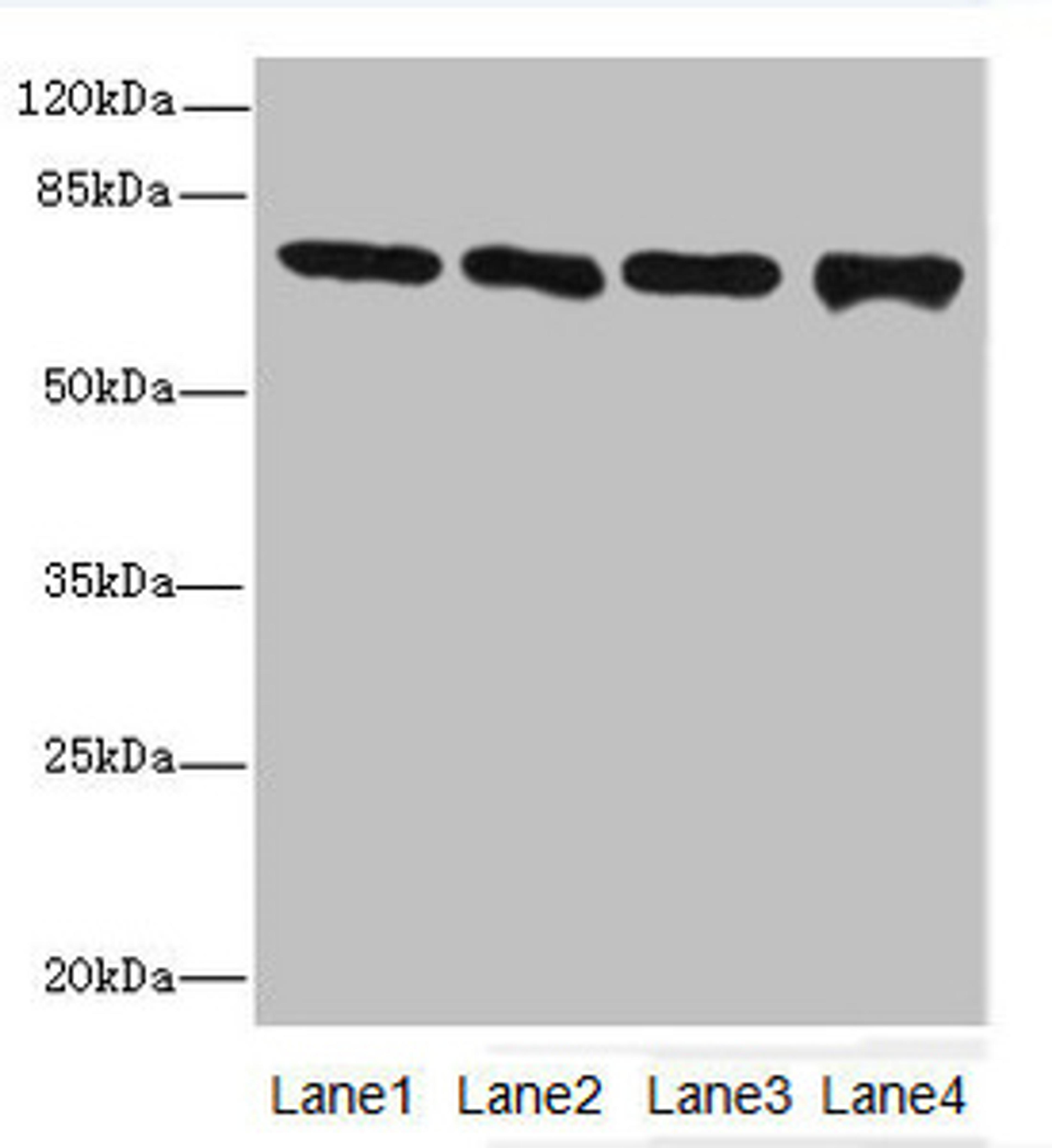 Western blot. All lanes: Protein-arginine deiminase type-2 antibody at 16ug/ml. Lane 1: PC-3 whole cell lysate. Lane 2: Hela whole cell lysate. Lane 3: Mouse brain tissue. Lane 4: MDA-MB-231 whole cell lysate. Secondary. Goat polyclonal to rabbit IgG at 1/10000 dilution. Predicted band size: 76, 50 kDa. Observed band size: 76 kDa. 