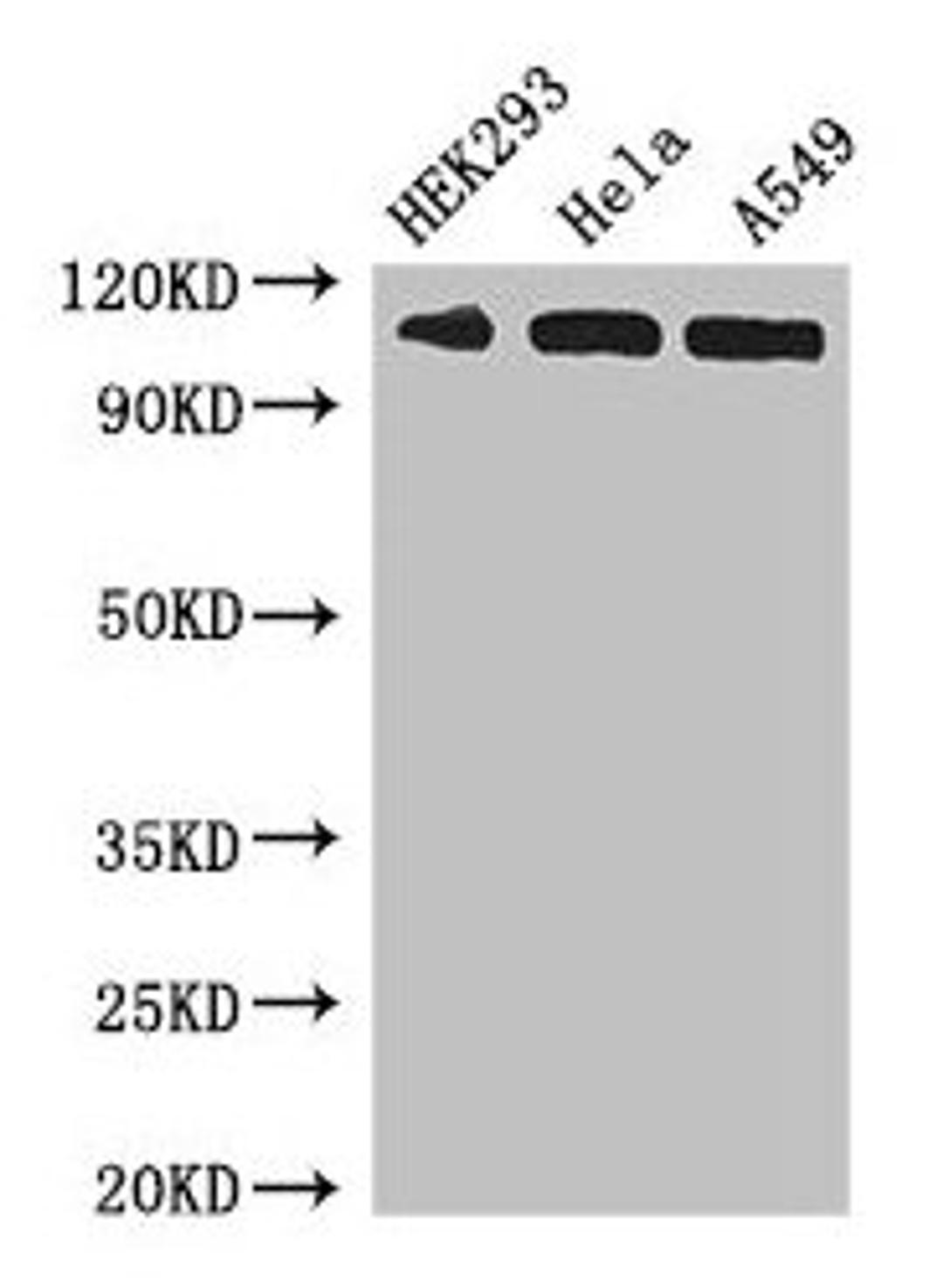 Western Blot. Positive WB detected in: HEK293 whole cell lysate, Hela whole cell lysate, A549 whole cell lysate. All lanes: IPO13 antibody at 3µg/ml. Secondary. Goat polyclonal to rabbit IgG at 1/50000 dilution. Predicted band size: 109 kDa. Observed band size: 109 kDa