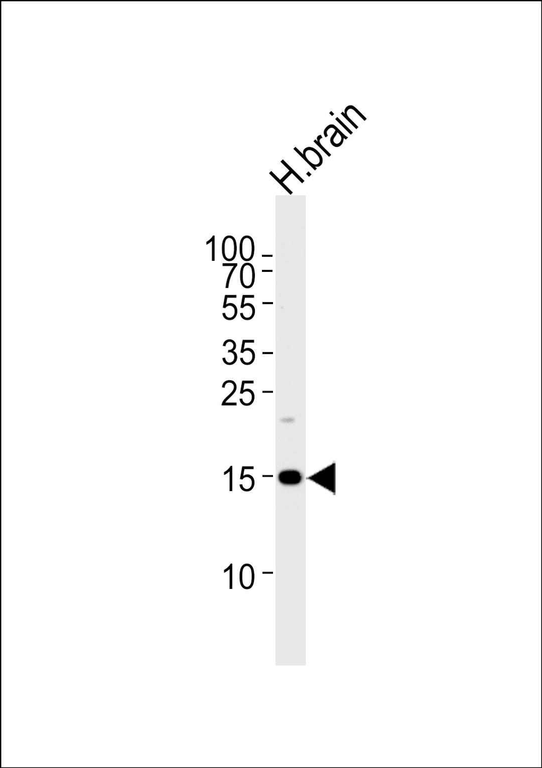 Western blot analysis of lysate from human brain tissue lysate, using SPRN Antibody at 1:1000 at each lane.