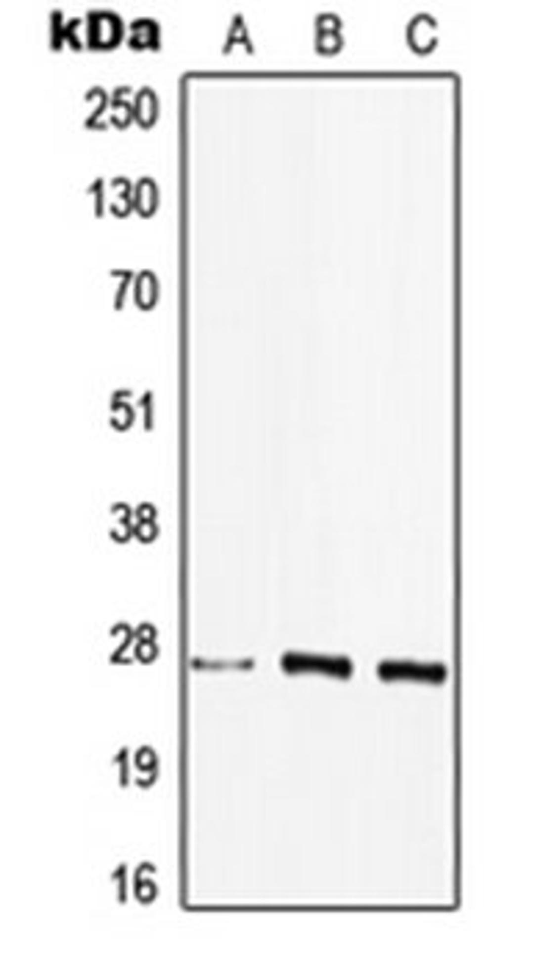 Western blot analysis of HEK293T (Lane 1), MCF7 (Lane 2), Raw264.7 (Lane 3) whole cell lysates using HLA-DQB2 antibody