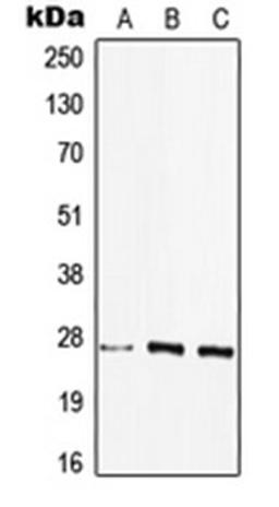 Western blot analysis of HEK293T (Lane 1), MCF7 (Lane 2), Raw264.7 (Lane 3) whole cell lysates using HLA-DQB2 antibody