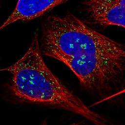 Immunocytochemistry/Immunofluorescence: PEX14 Antibody [NBP2-33556] - Staining of human cell line U-2 OS shows positivity in nucleoli & vesicles.