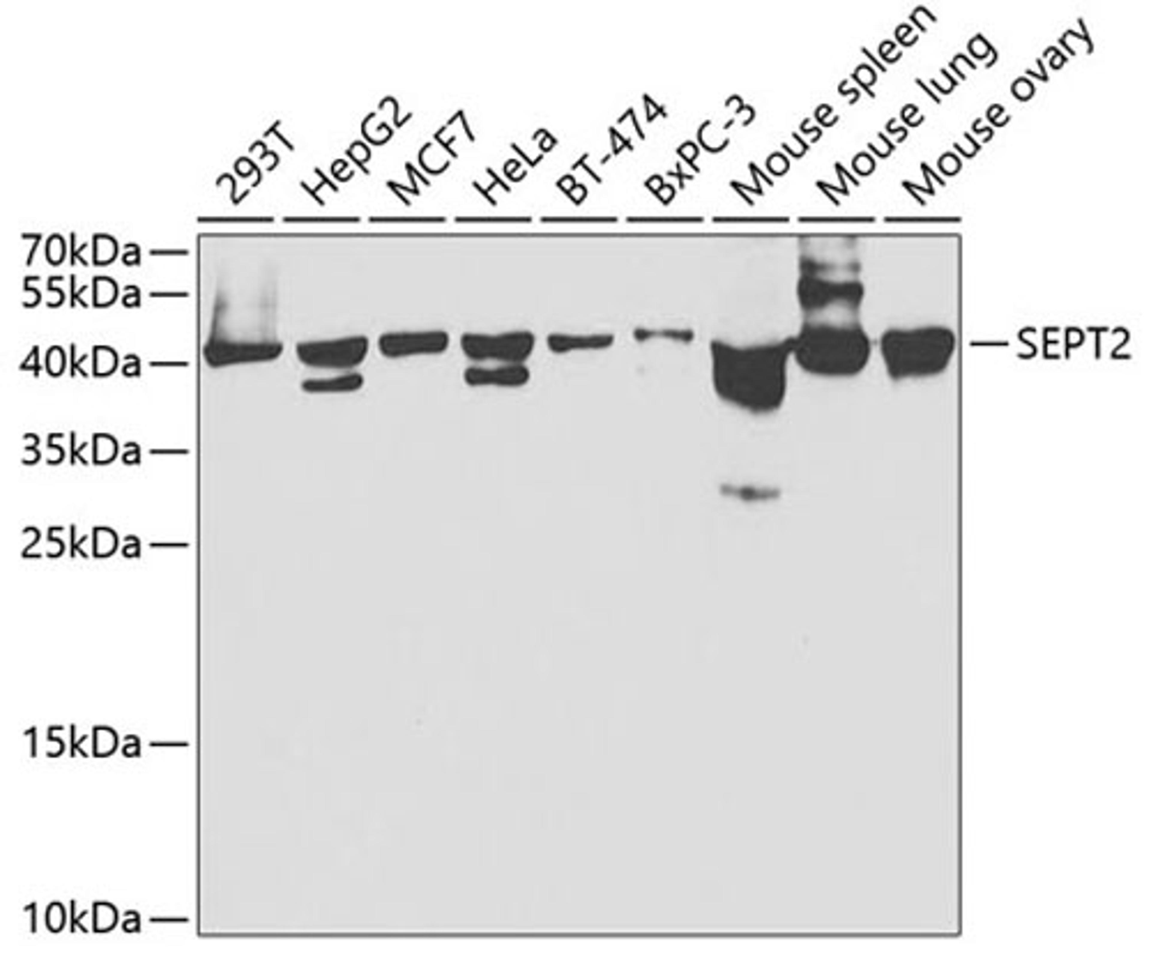 Western blot - SEPT2 antibody (A5801)