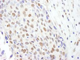 Detection of human SF3b145/SAP145 by immunohistochemistry.