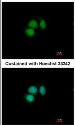 Immunocytochemistry/Immunofluorescence: CUGBP2 Antibody [NBP2-16035] - Analysis of paraformaldehyde-fixed MCF-7, using antibody at 1:500 dilution.