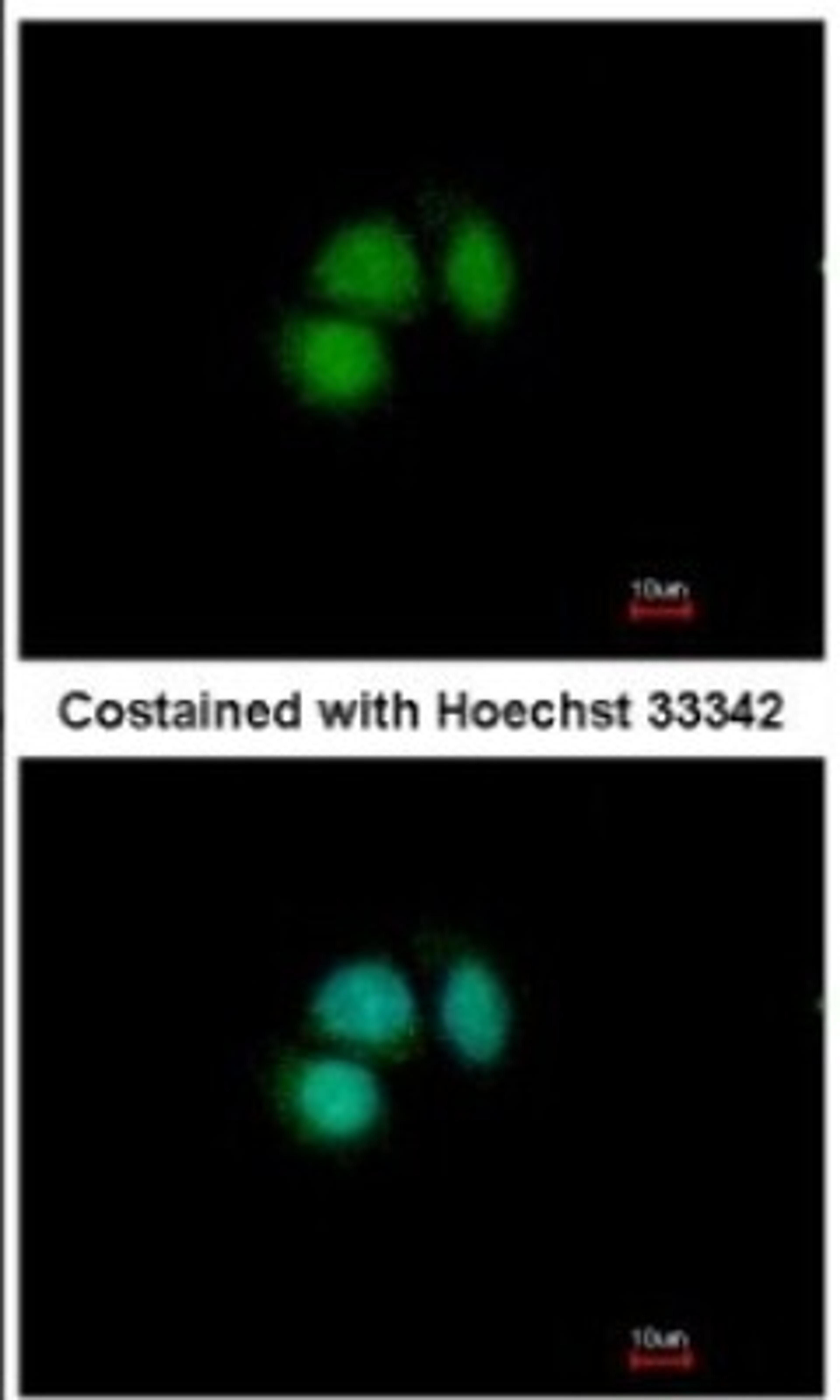 Immunocytochemistry/Immunofluorescence: CUGBP2 Antibody [NBP2-16035] - Analysis of paraformaldehyde-fixed MCF-7, using antibody at 1:500 dilution.