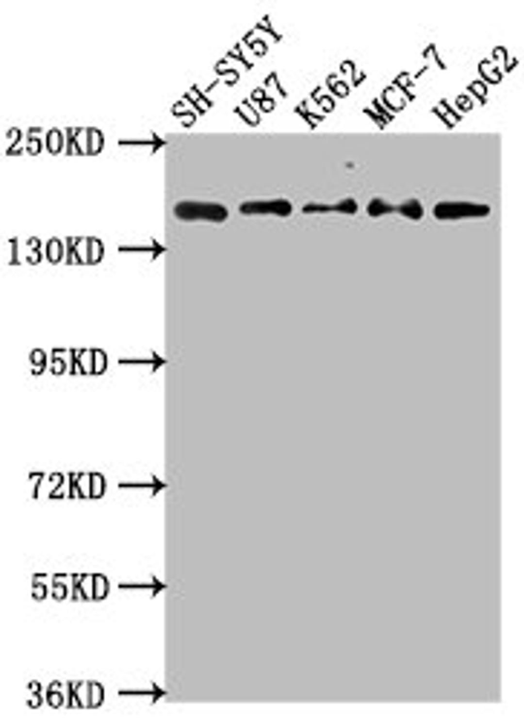 Western Blot. Positive WB detected in: SH-SY5Y whole cell lysate, U87 whole cell lysate, K562 whole cell lysate, MCF-7 whole cell lysatee, HepG2 whole cell lysate. All lanes: INSRR antibody at 1:2000. Secondary. Goat polyclonal to rabbit IgG at 1/50000 dilution. Predicted band size: 144 kDa. Observed band size: 144 kDa.