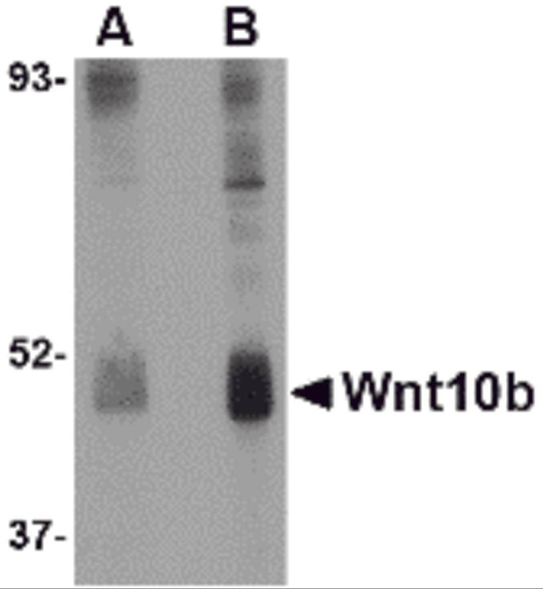 Western blot analysis of Wnt10b in human skeletal muscle tissue lysate with Wnt10b antibody at (A) 2 and (B) 4 &#956;g/mL.