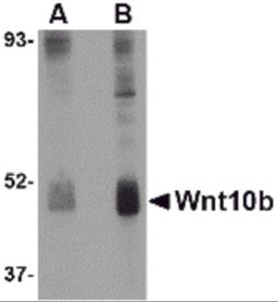 Western blot analysis of Wnt10b in human skeletal muscle tissue lysate with Wnt10b antibody at (A) 2 and (B) 4 &#956;g/mL.