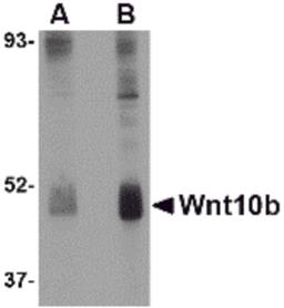 Western blot analysis of Wnt10b in human skeletal muscle tissue lysate with Wnt10b antibody at (A) 2 and (B) 4 μg/mL.