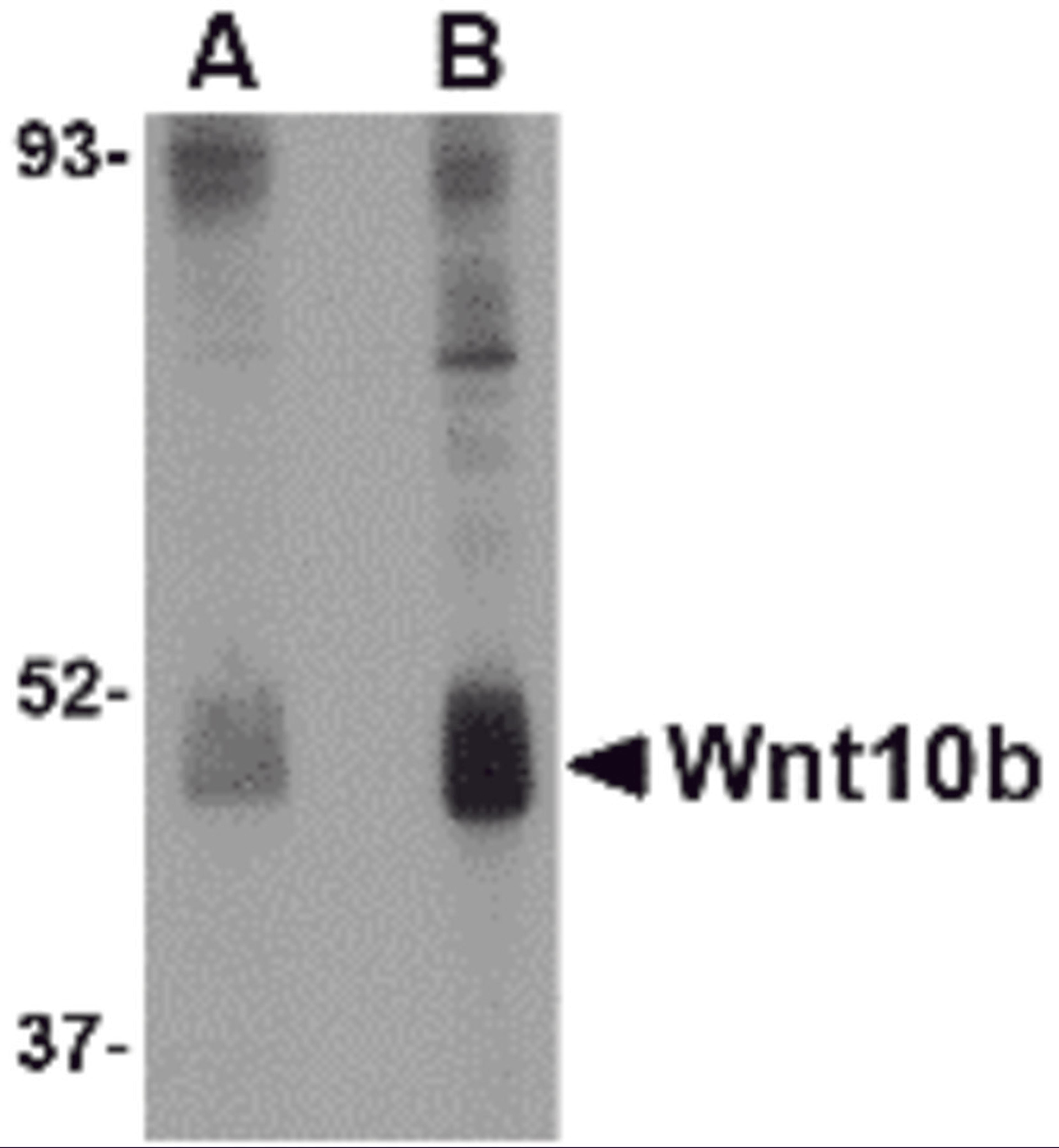 Western blot analysis of Wnt10b in human skeletal muscle tissue lysate with Wnt10b antibody at (A) 2 and (B) 4 μg/mL.