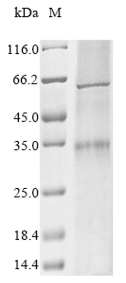 (Tris-Glycine gel) Discontinuous SDS-PAGE (reduced) with 5% enrichment gel and 15% separation gel.