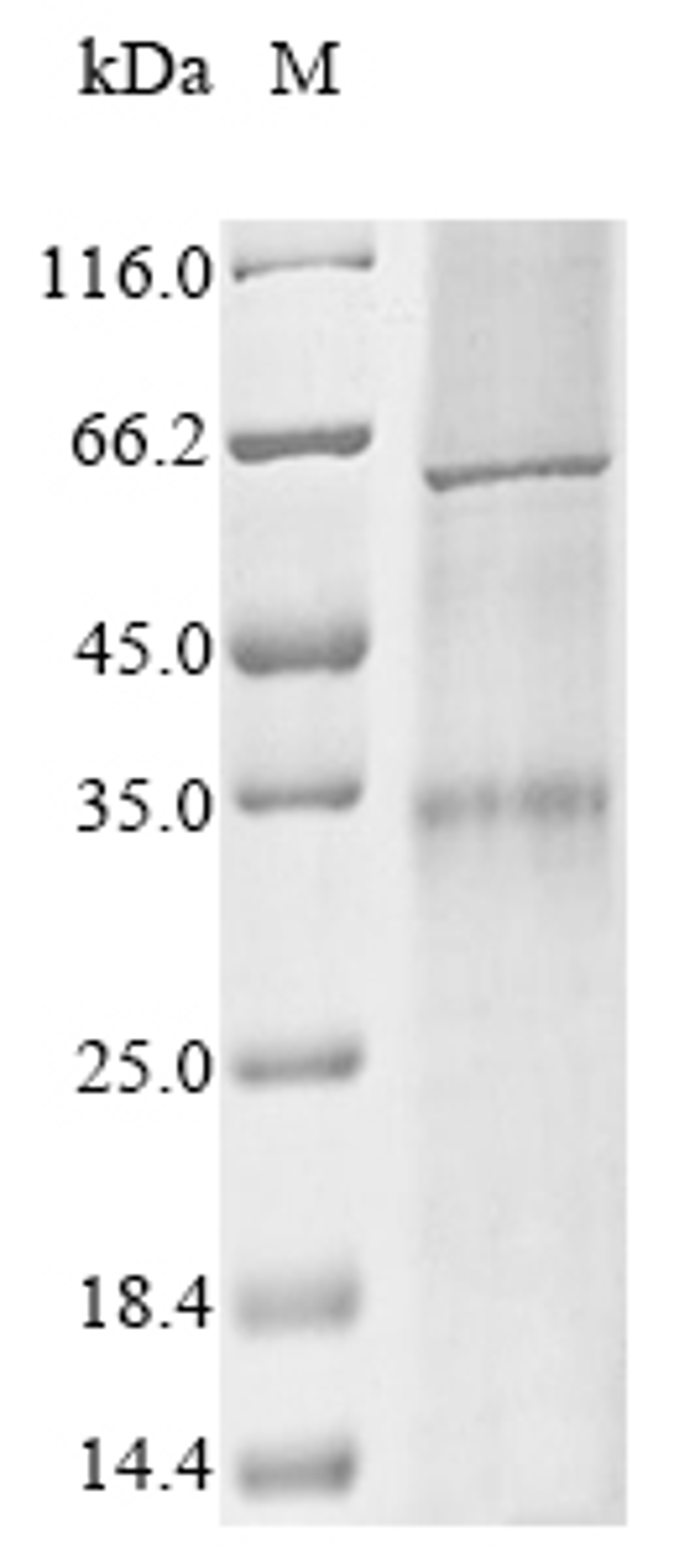 (Tris-Glycine gel) Discontinuous SDS-PAGE (reduced) with 5% enrichment gel and 15% separation gel.