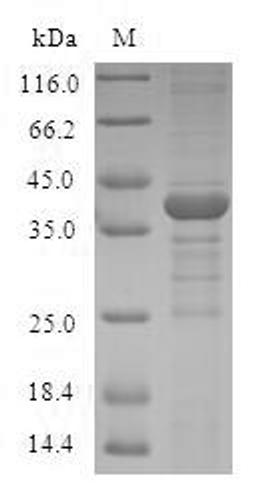 (Tris-Glycine gel) Discontinuous SDS-PAGE (reduced) with 5% enrichment gel and 15% separation gel.