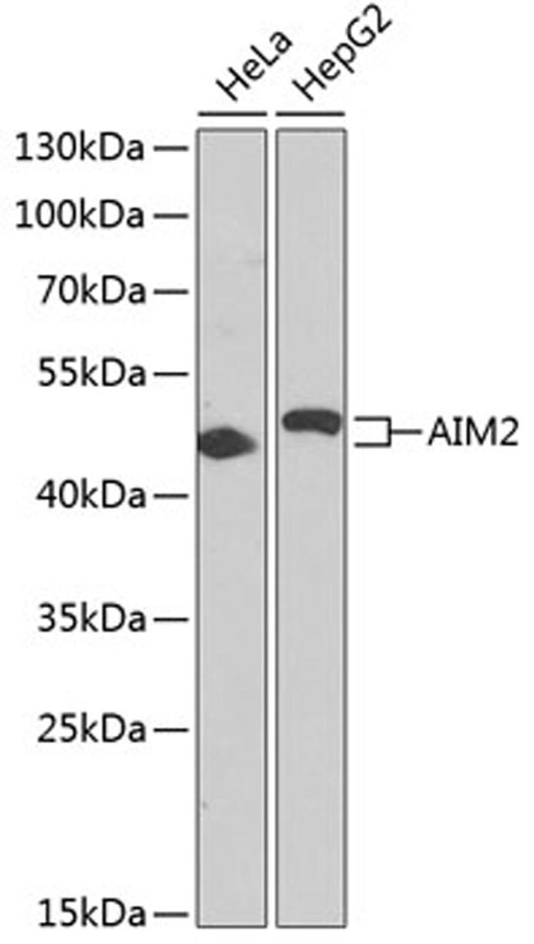 Western blot - AIM2 antibody (A3356)