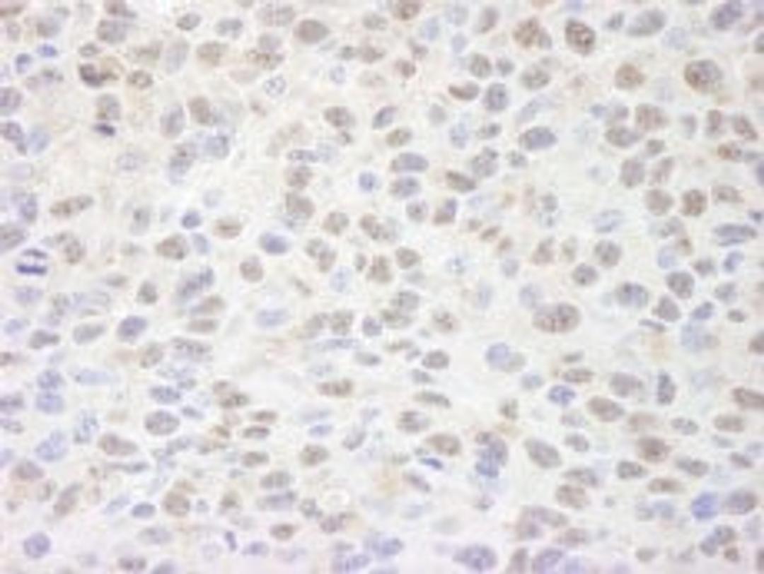 Detection of mouse Sin3A by immunohistochemistry.