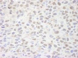 Detection of mouse Sin3A by immunohistochemistry.