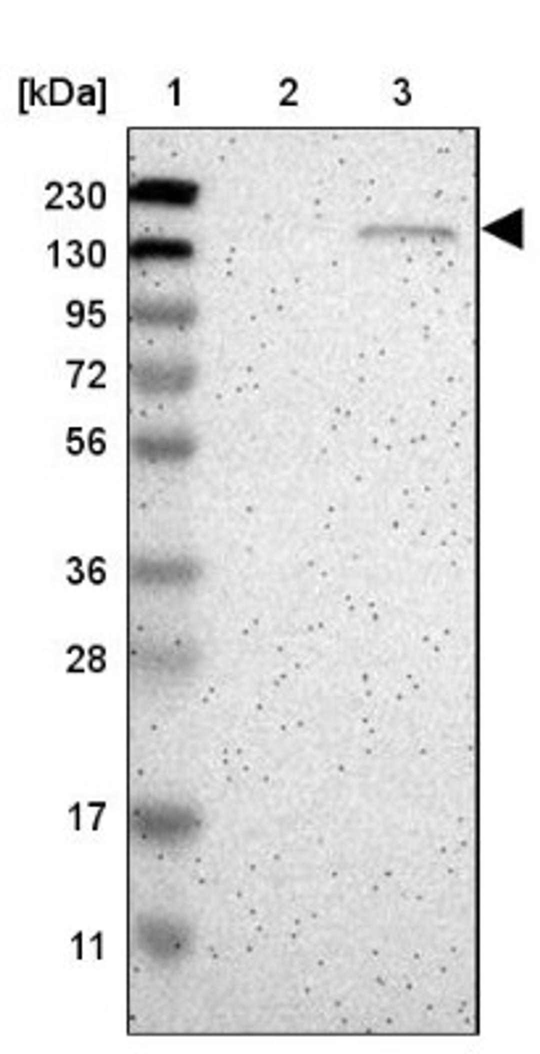 Western Blot: golgi glycoprotein 1 Antibody [NBP1-90636] - Lane 1: Marker [kDa] 230, 130, 95, 72, 56, 36, 28, 17, 11<br/>Lane 2: Human cell line RT-4<br/>Lane 3: Human cell line U-251MG sp