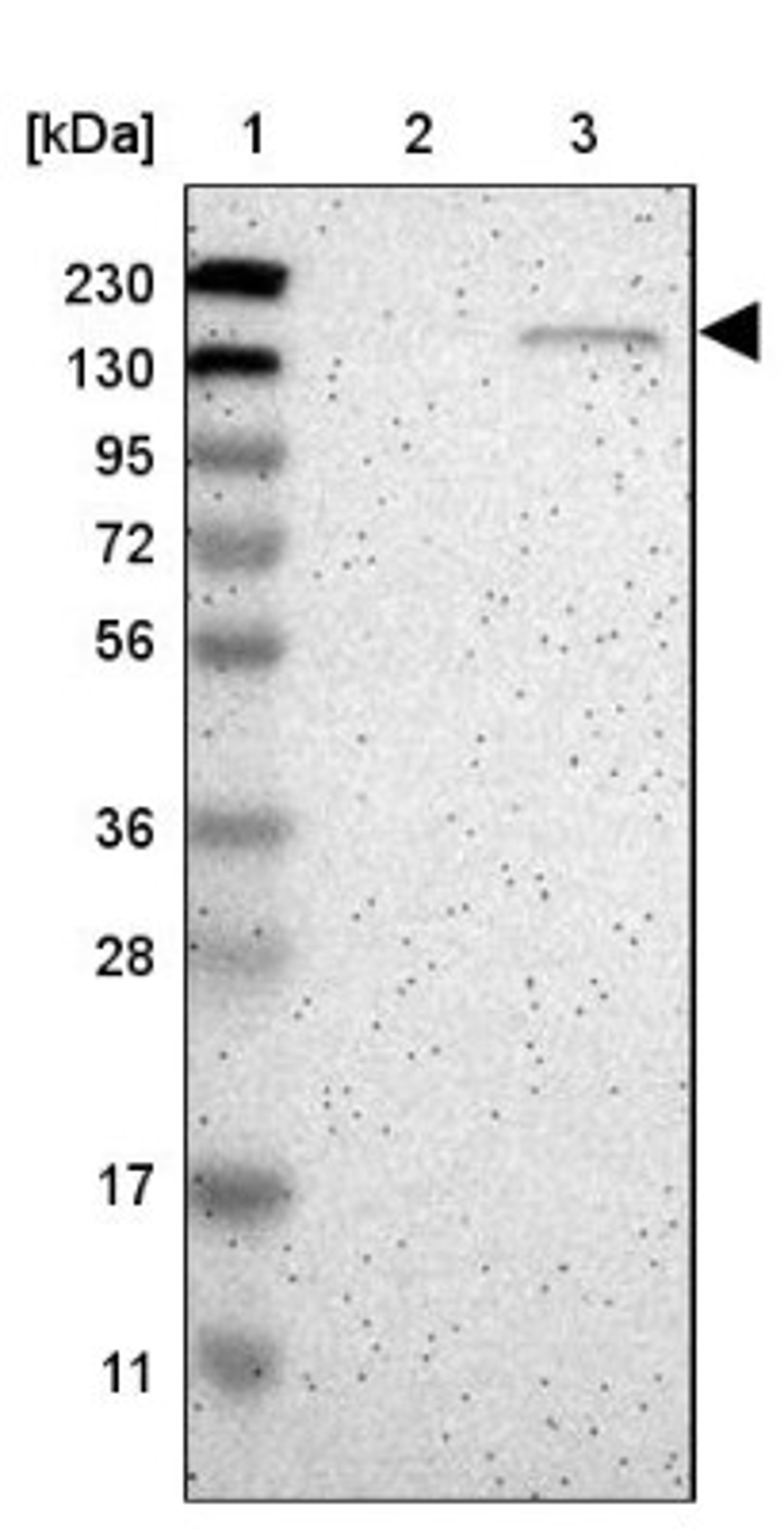 Western Blot: golgi glycoprotein 1 Antibody [NBP1-90636] - Lane 1: Marker [kDa] 230, 130, 95, 72, 56, 36, 28, 17, 11<br/>Lane 2: Human cell line RT-4<br/>Lane 3: Human cell line U-251MG sp