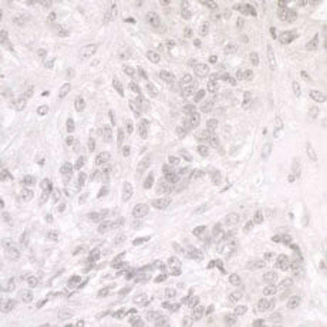 Detection of human SMARCA1/SNF2L by immunohistochemistry.