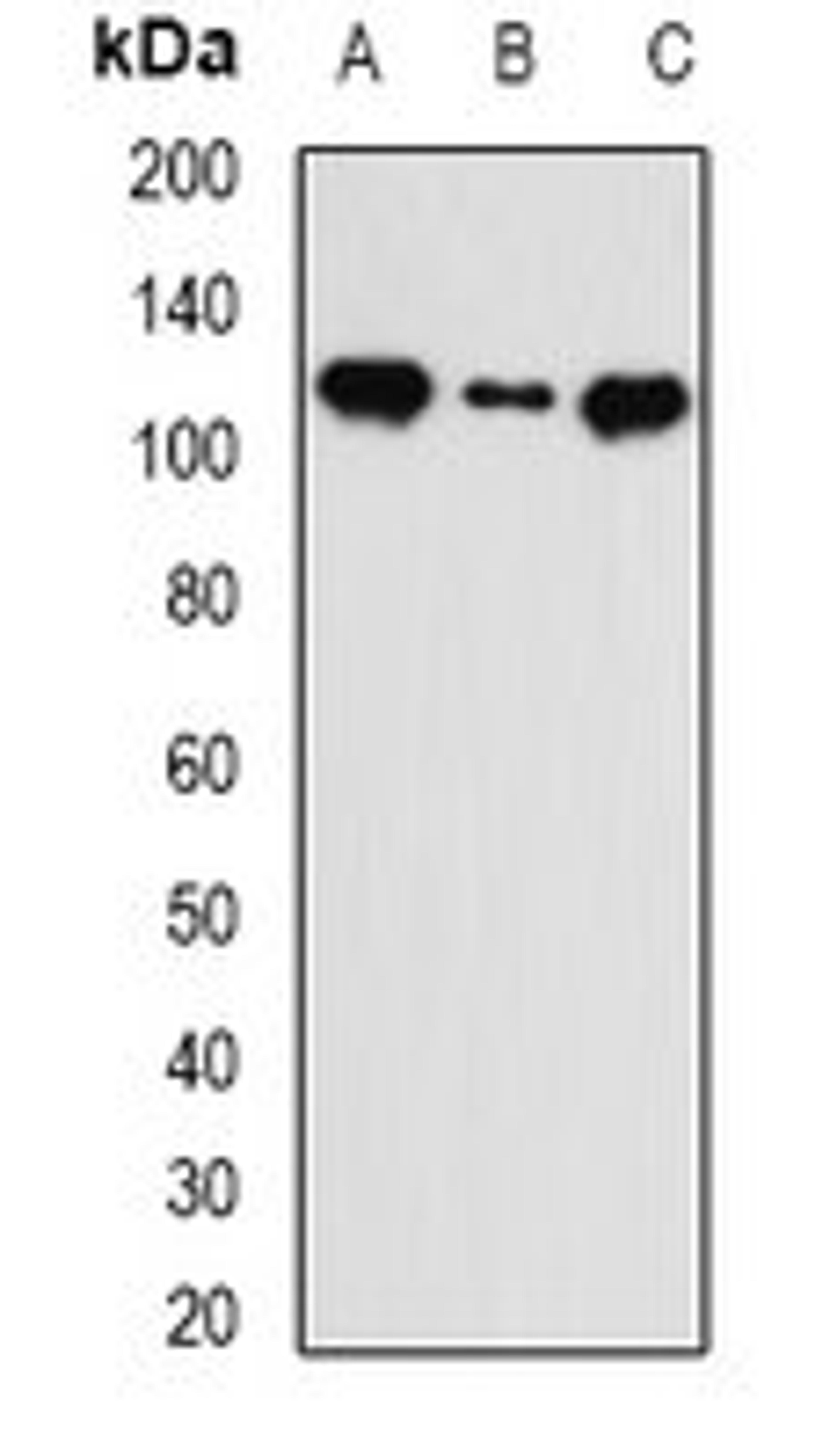 Western blot analysis of MCF7 (Lane1), HT29 (Lane2), mouse liver (Lane3) whole cell lysates using INTS5 antibody