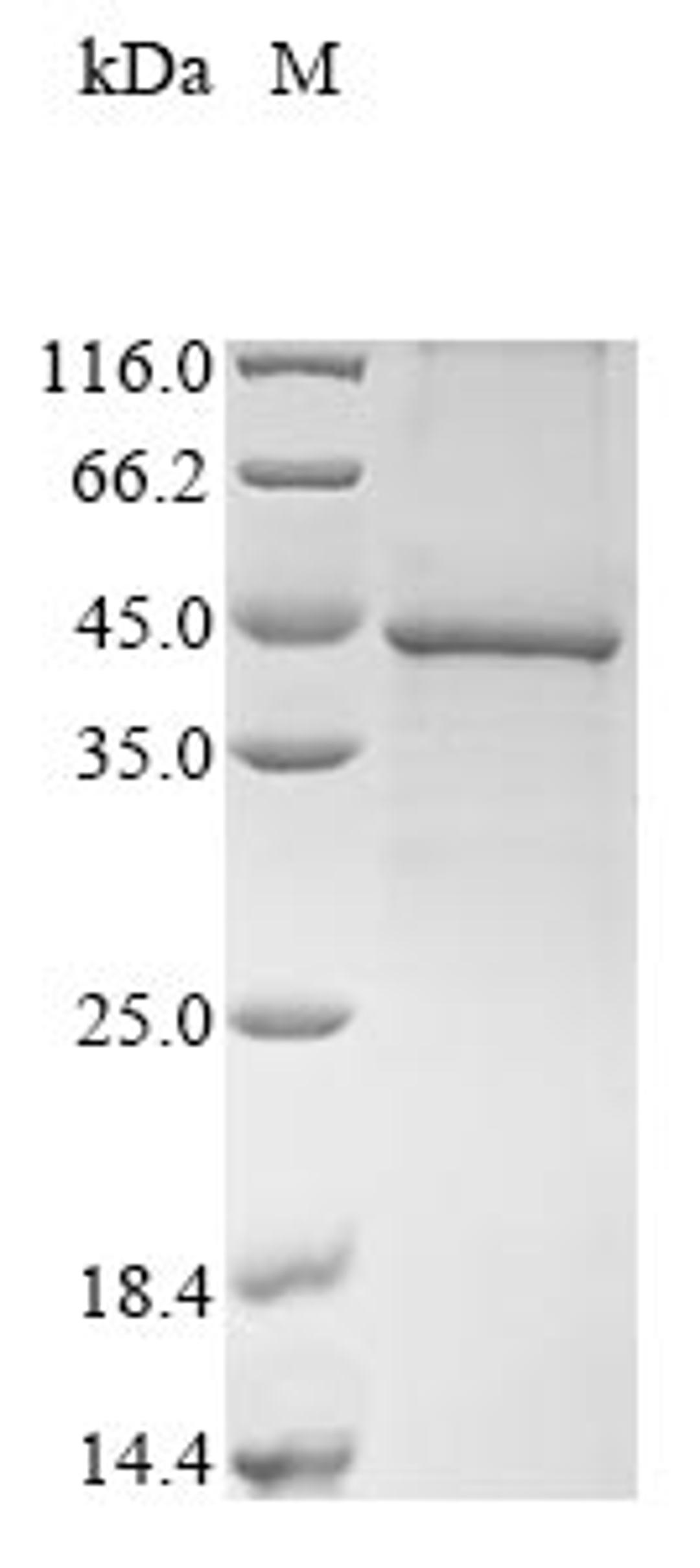 (Tris-Glycine gel) Discontinuous SDS-PAGE (reduced) with 5% enrichment gel and 15% separation gel.