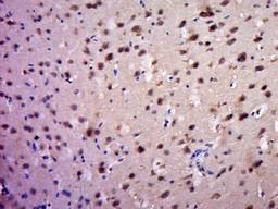 Immunohistochemical staining of Mouse brain tissue using PROP1 antibody.