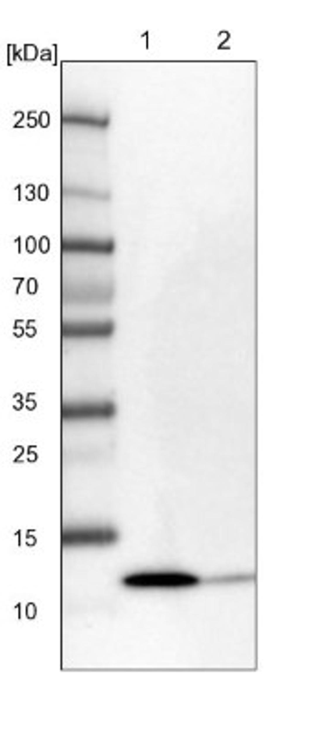 Western Blot: HSPC280 Antibody [NBP1-81670] - Lane 1: NIH-3T3 cell lysate (Mouse embryonic fibroblast cells)<br/>Lane 2: NBT-II cell lysate (Rat Wistar bladder tumour cells)