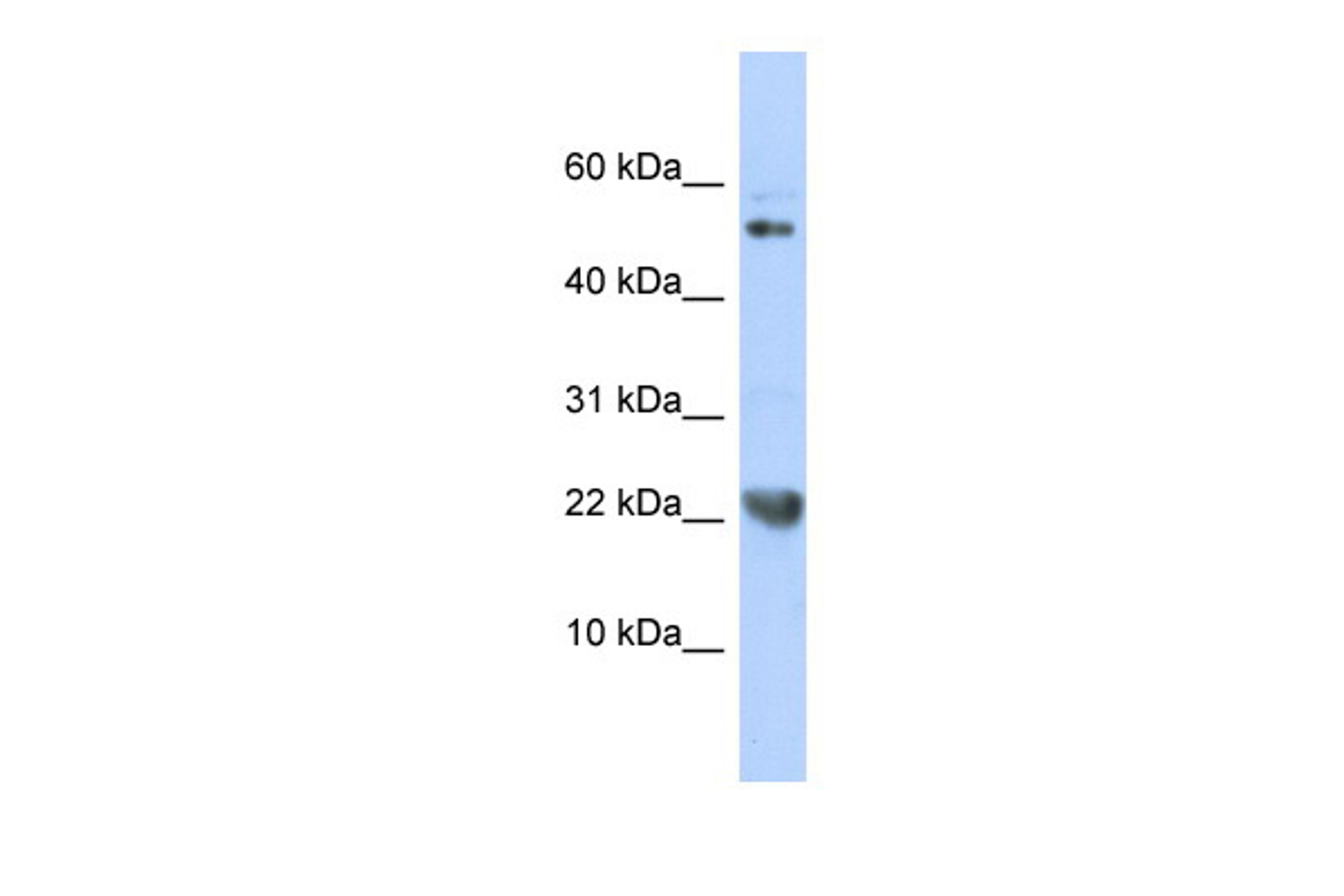 Antibody used in WB on Human 721_B at 0.2-1 ug/ml.