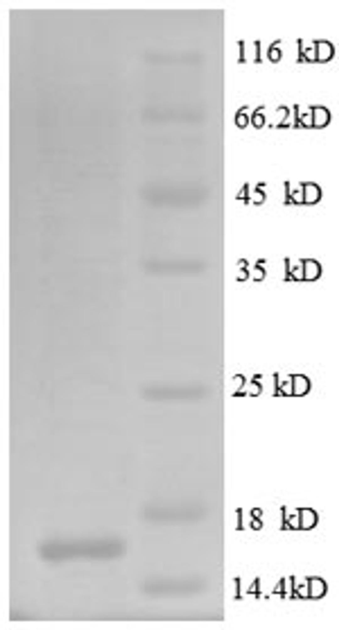 (Tris-Glycine gel) Discontinuous SDS-PAGE (reduced) with 5% enrichment gel and 15% separation gel.