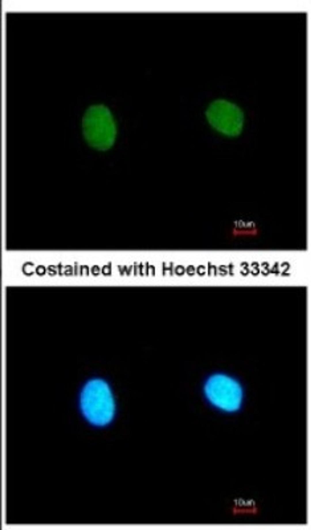 Immunocytochemistry/Immunofluorescence: MED18 Antibody [NBP2-17257] - Analysis of paraformaldehyde-fixed HeLa, using antibody at 1:200 dilution.