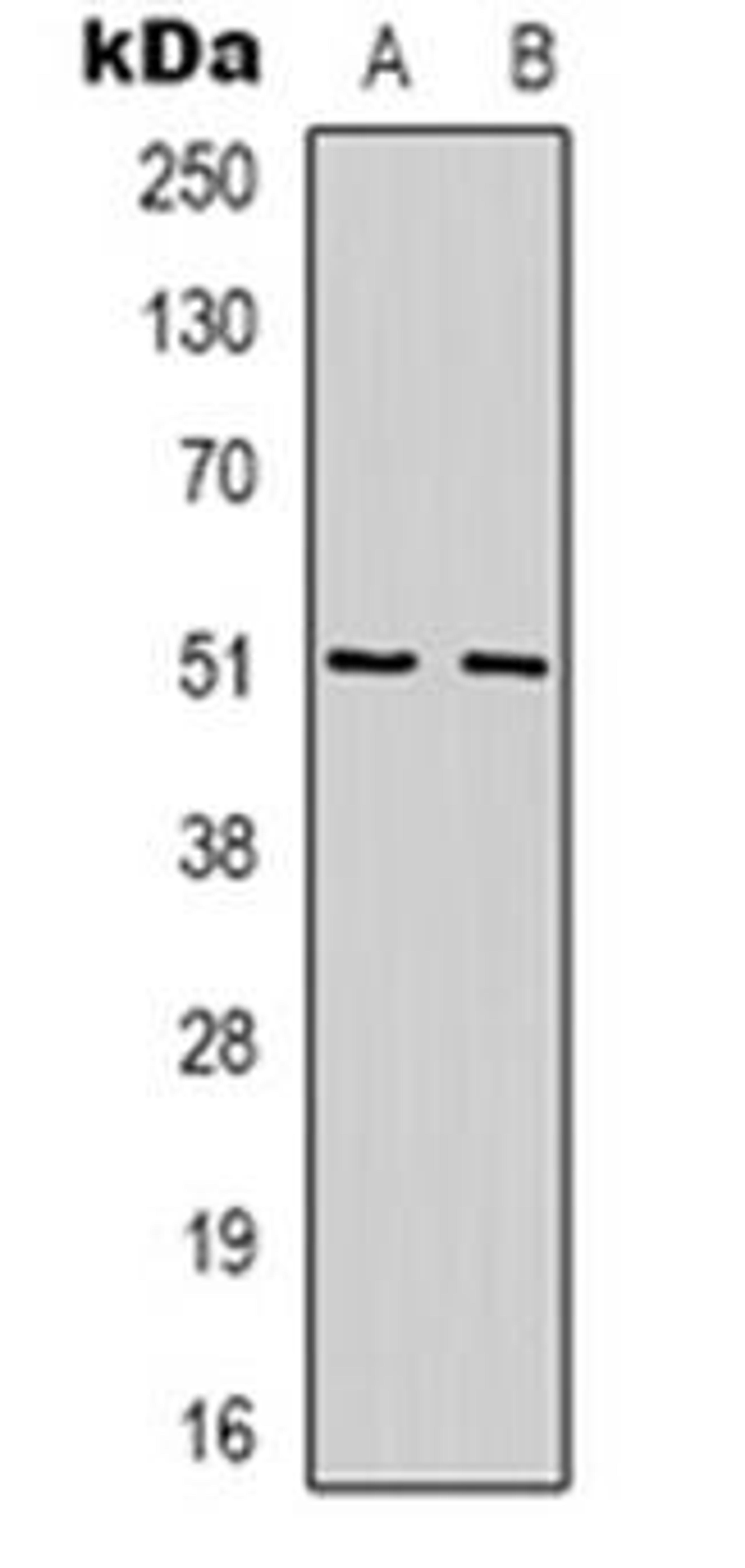 Western blot analysis of WIPF1 expression in Jurkat (Lane 1), K562 (Lane 2) whole cell lysates using WIPF1 antibody