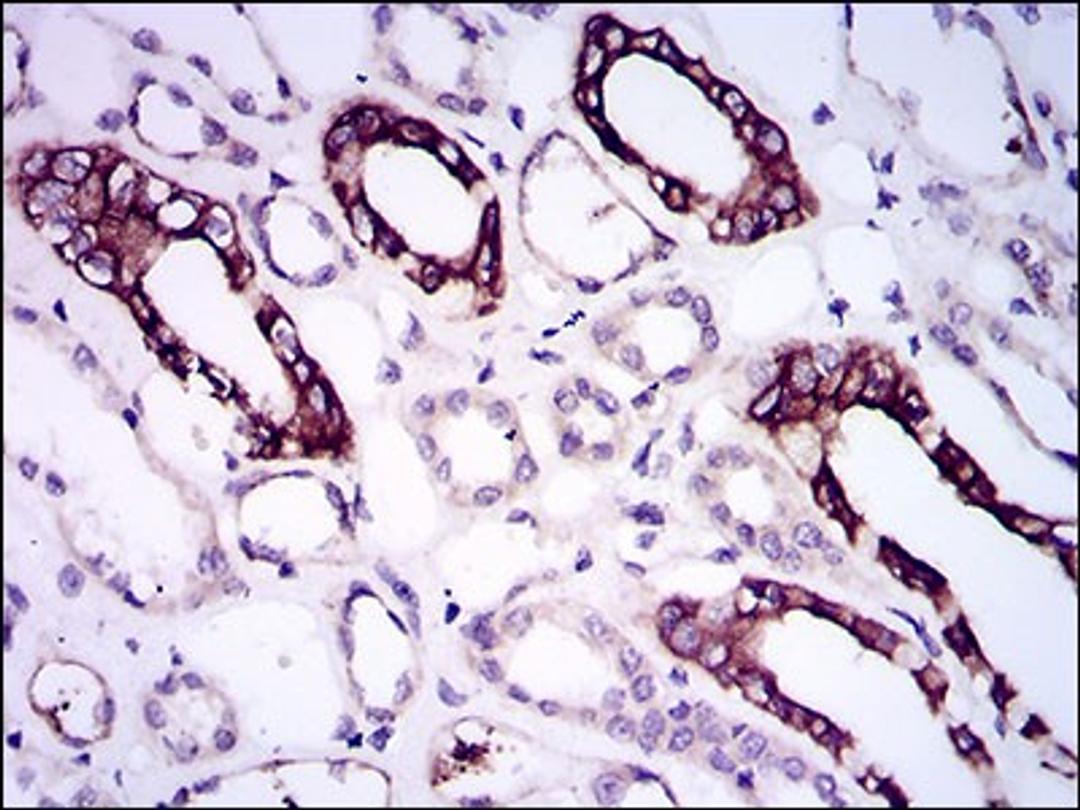 Immunohistochemistry: BMPR-IA/ALK-3 Antibody (4B7B2) [NBP2-37421] - Immunohistochemical analysis of paraffin-embedded kidney tissues using BMPR1A mouse mAb with DAB staining.