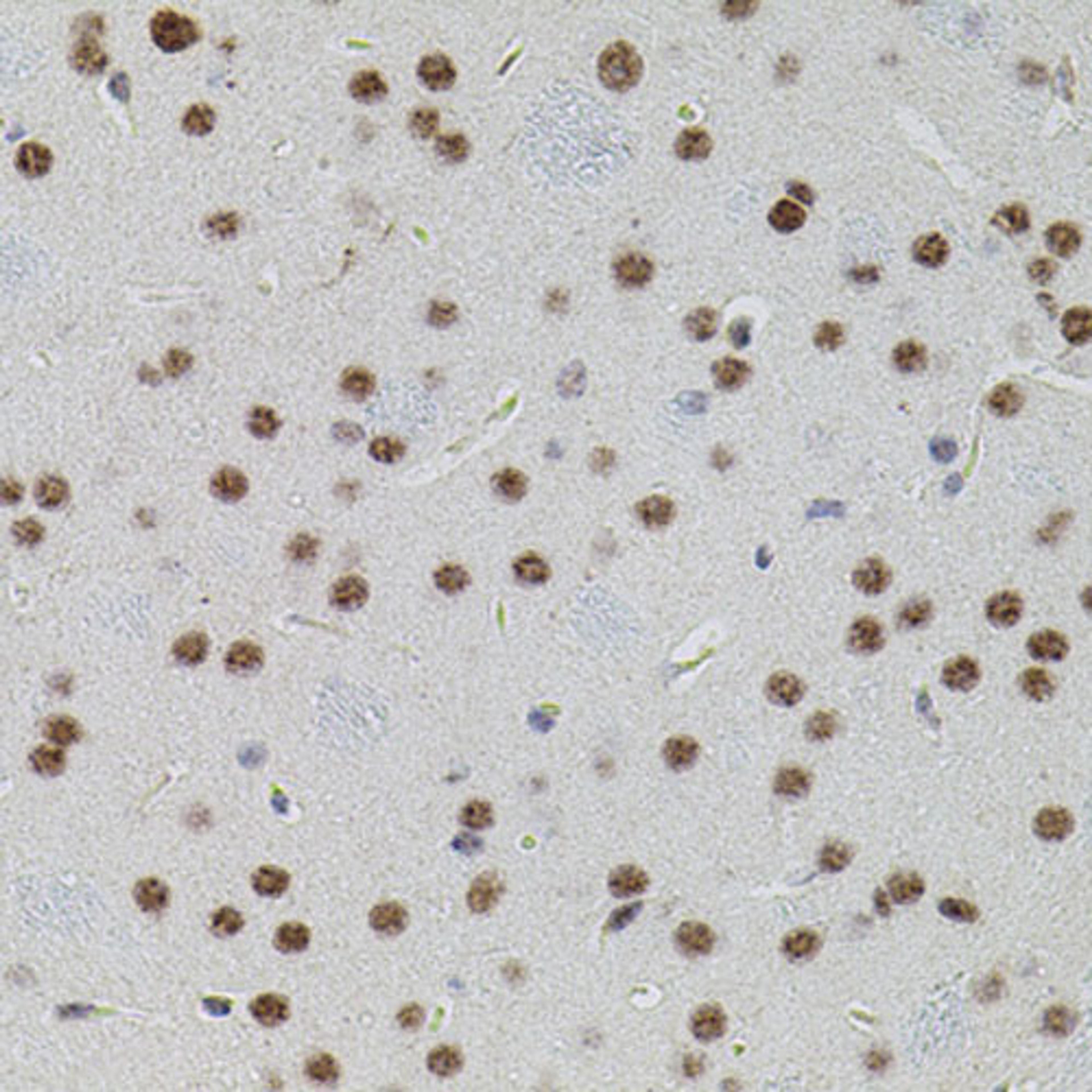 Immunohistochemistry  - SMAD5 antibody (A0635)