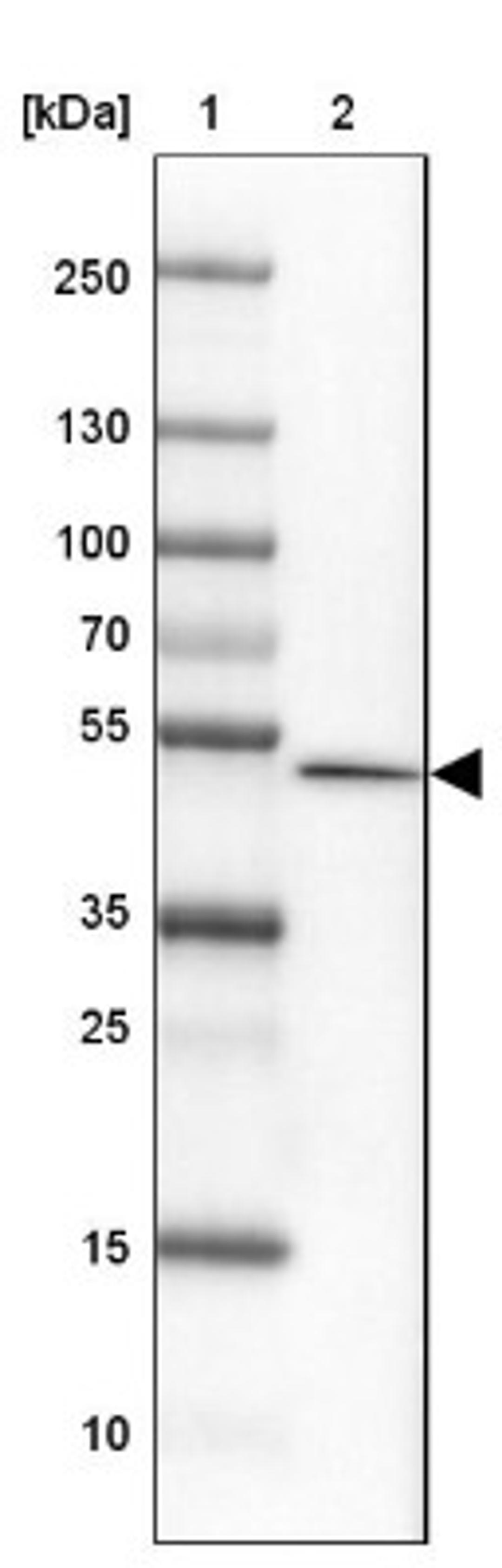 Western Blot: FAM155A Antibody [NBP1-90982] - Lane 1: Marker [kDa] 250, 130, 100, 70, 55, 35, 25, 15, 10<br/>Lane 2: Cerebral Cortex