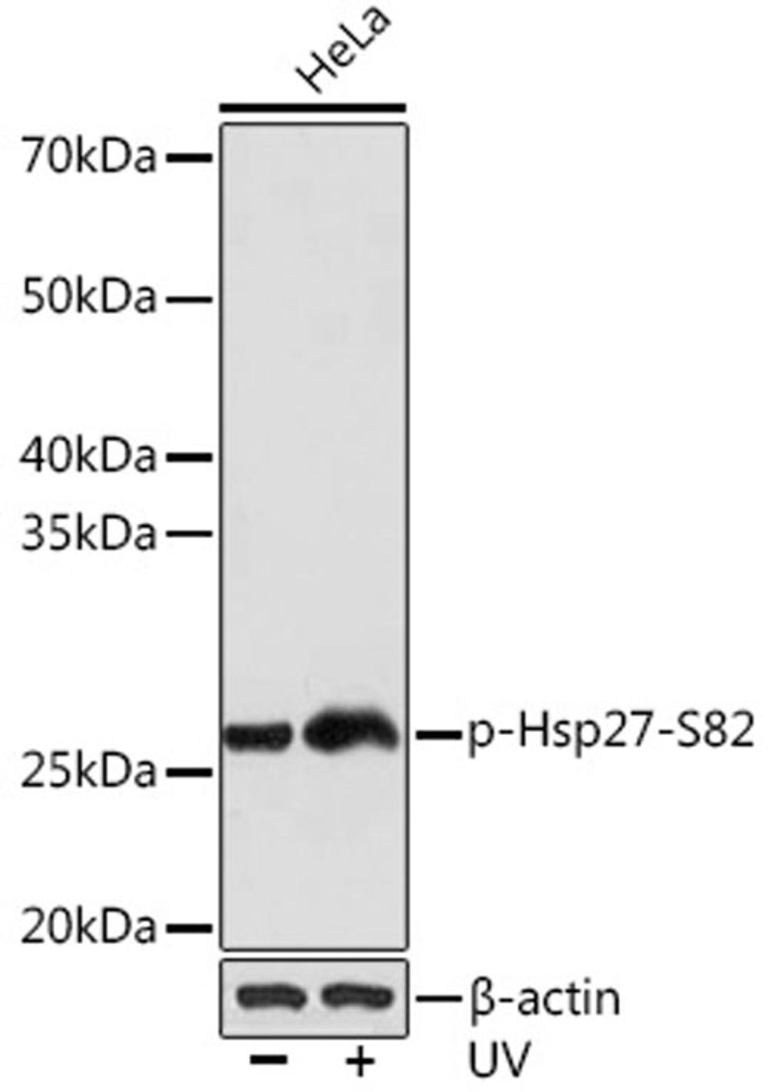 Western blot - Phospho-Hsp27-S82 Rabbit mAb (AP1031)