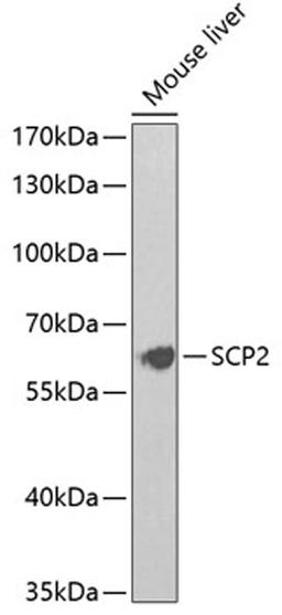 Western blot - SCP2 Antibody (A5382)